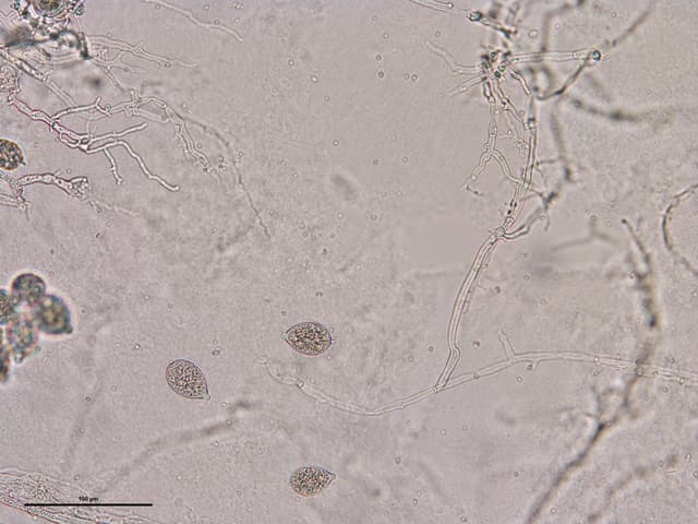 Phytophthora spp. — Oomycete pathogen · potato / forestry